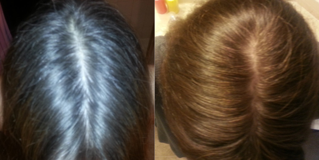Gray Hair Roots Comparison