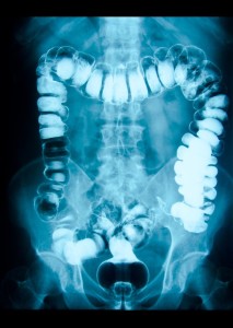 Seems age 50 is the magic number when they want you to get your colon checked out. For those like me, who dont have xray vision, heres what it looks like!